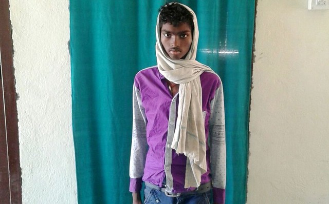 Kundan Kumar, the 16 year old boy who is suffering from Tuberclousis.jpg